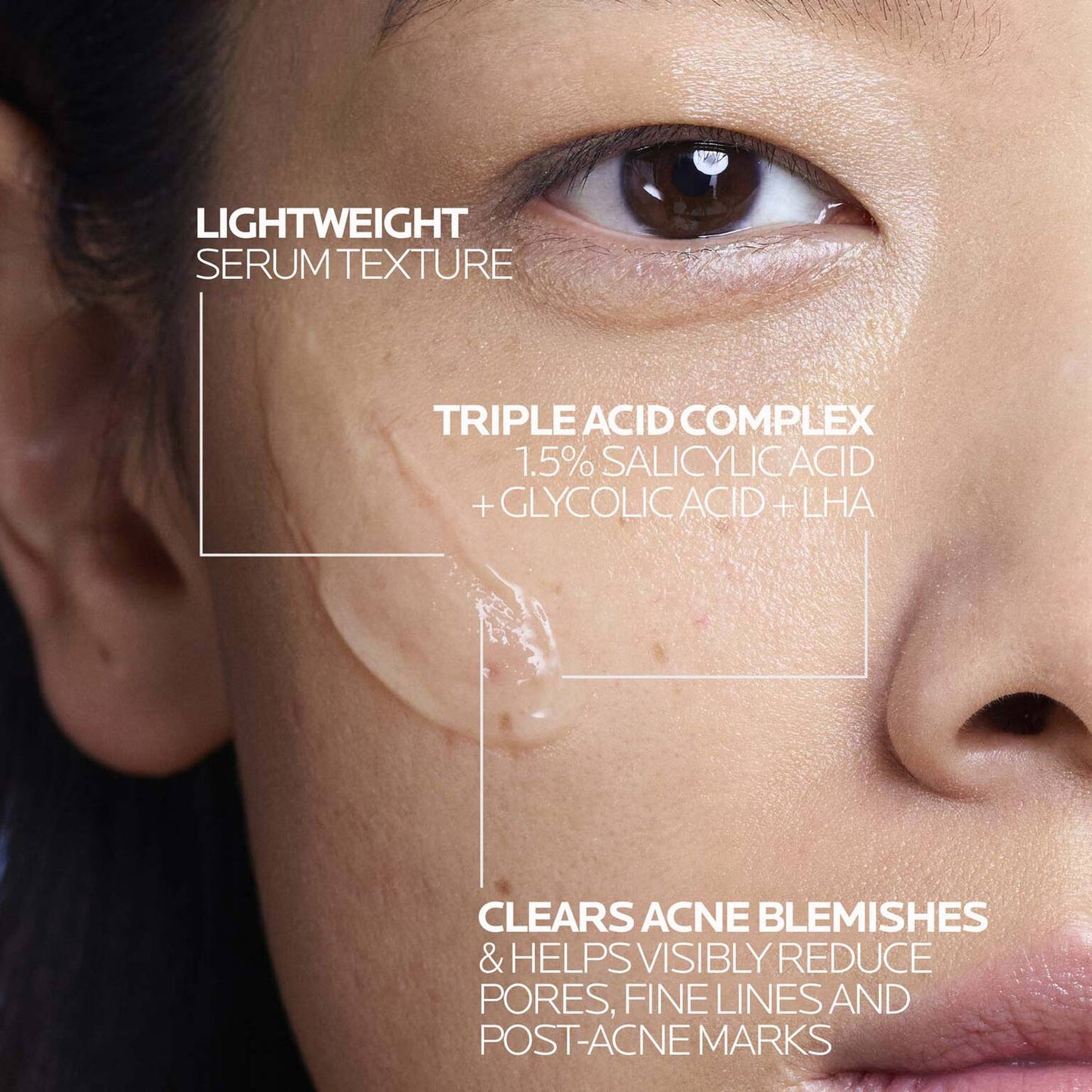 effaclar-salicylic-acid-acne-treatment-serum-y8 LaRochePosay-Product-Effaclar-Effaclar-Serum-30ml-3337875722827-Texture-REV.jpg