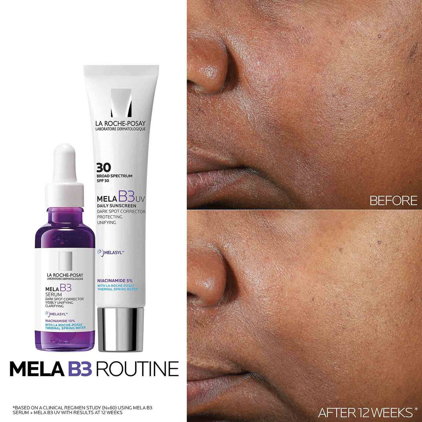 mela-b3-uv-daily-moisturizer-spf-30-with-melasyltm-niacinamide-c8 Mela-B3-routine_1500X1500.jpg